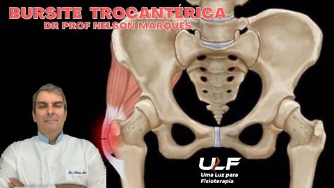 BURSITE TROCANTÉRICA - Dr. Prof. Nelson Marques