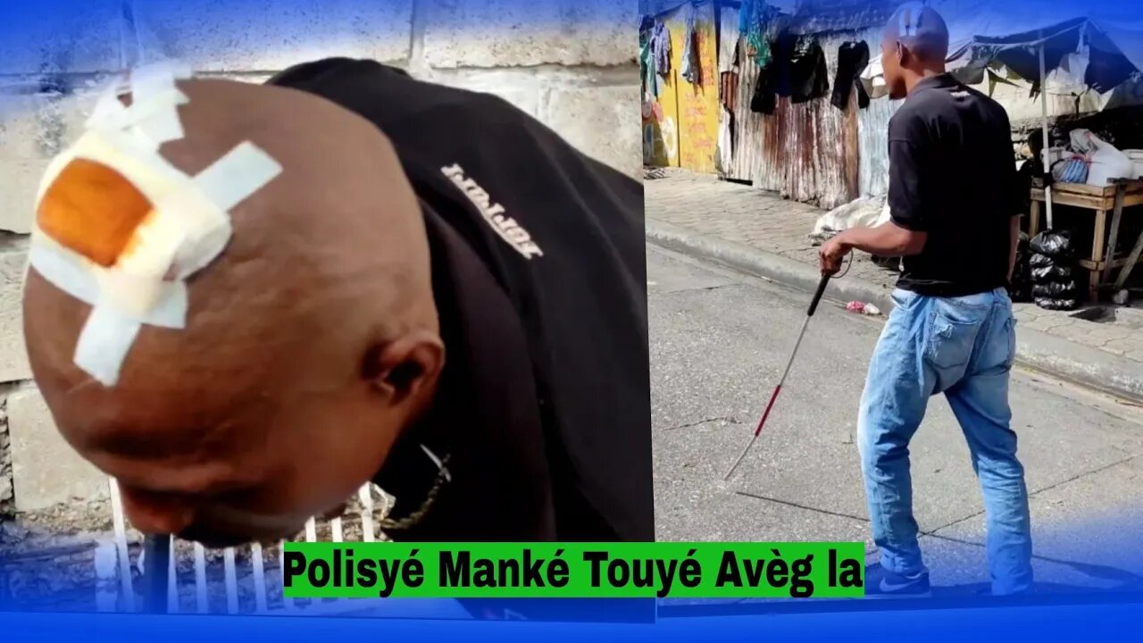 yon Polisyé Manké Touyé Yon yon Avèg 😭