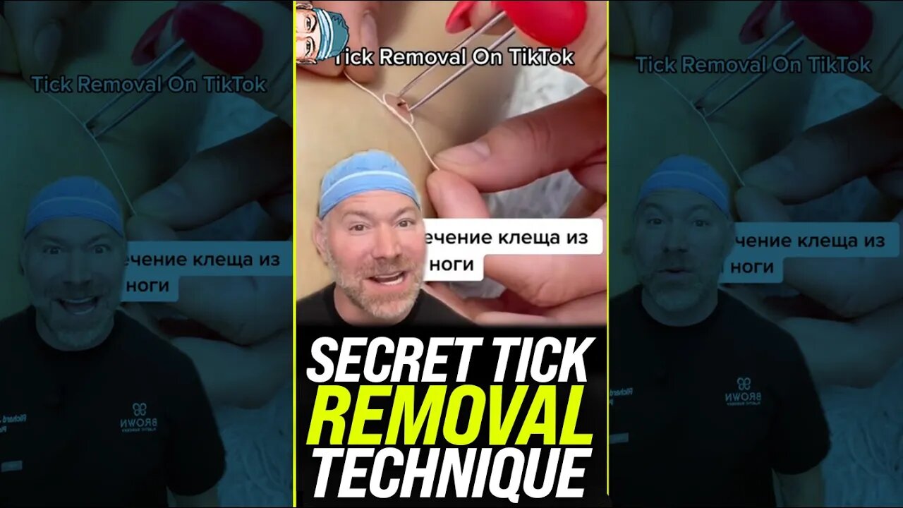 Secret Tick Removal Technique 🤫 #shorts