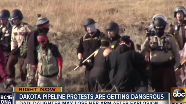 A Dakota Access pipeline protester could lose an arm