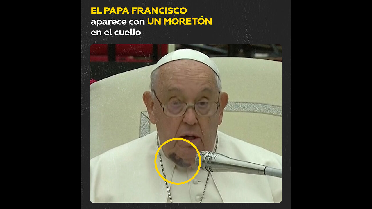 El papa Francisco aparece en público con un hematoma en el cuello