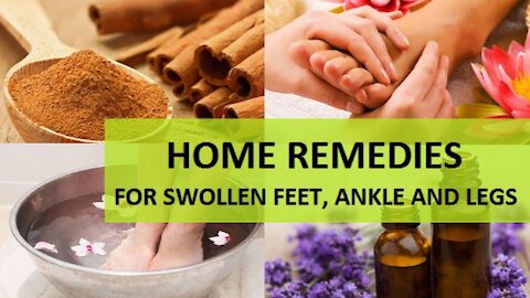 Home Remedies for Swollen Feet