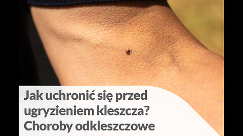 Jak uchronić się przed ugryzieniem kleszcza... Choroby odkleszczowe...