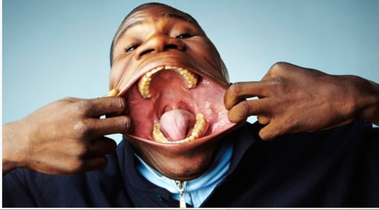 Biggest human mouth in the world