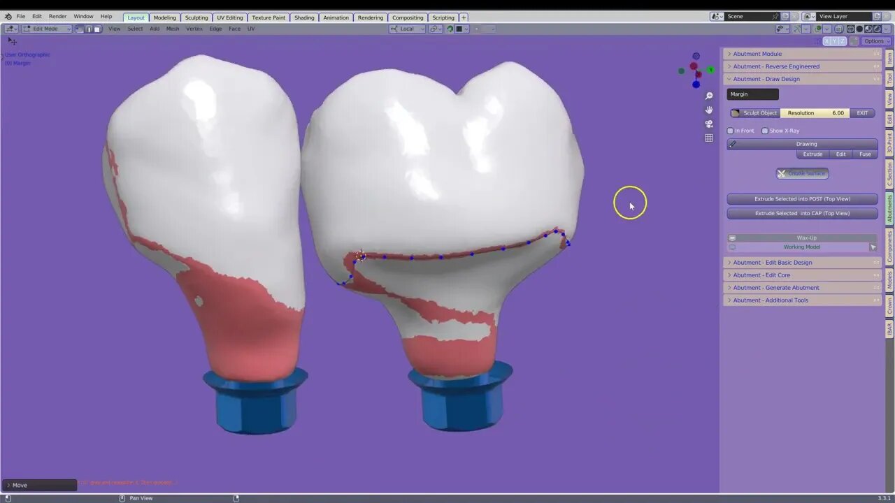 B4D testing of the Abutment module.