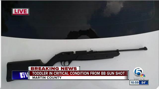 Toddler shot in head with BB gun