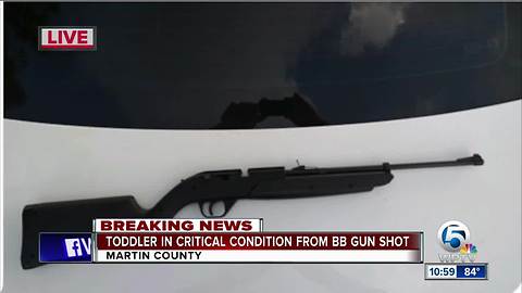 Toddler shot in head with BB gun