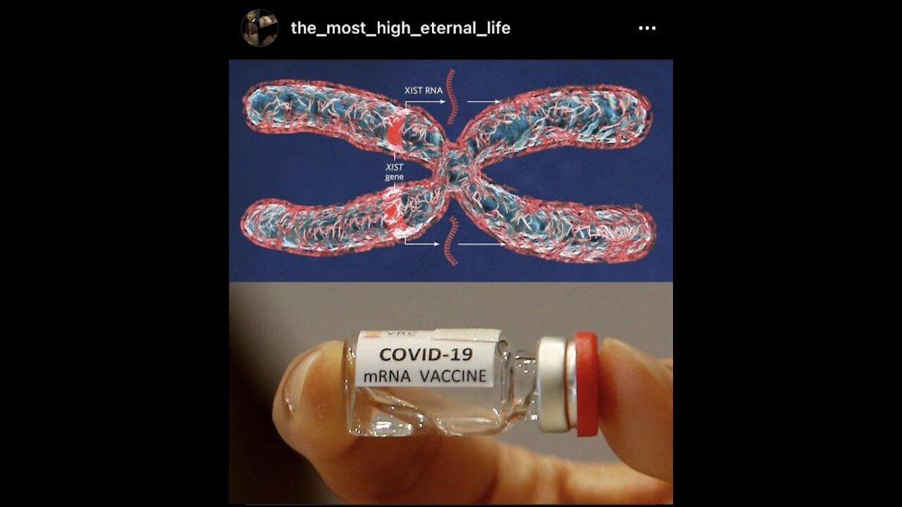 X-Out The Vx Modification by Mod de RNA to Eliminate the Female Chromosome