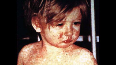 💥 Former Pfizer VP Dr. Michael Yeadon Warns Against "Vaccinating" Children