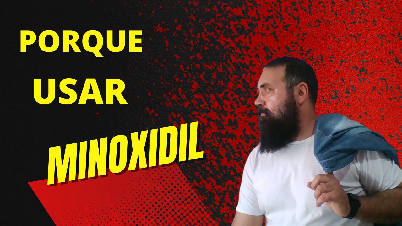 Falhas na Barba QUEDA DE CABELO #falhasdebarba #quedadecabelos #calvicemasculina #minoxidil