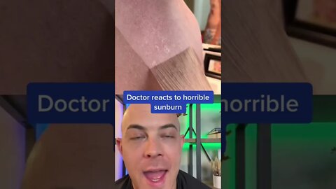 So Painful! Doctor reacts to sunburn peeling