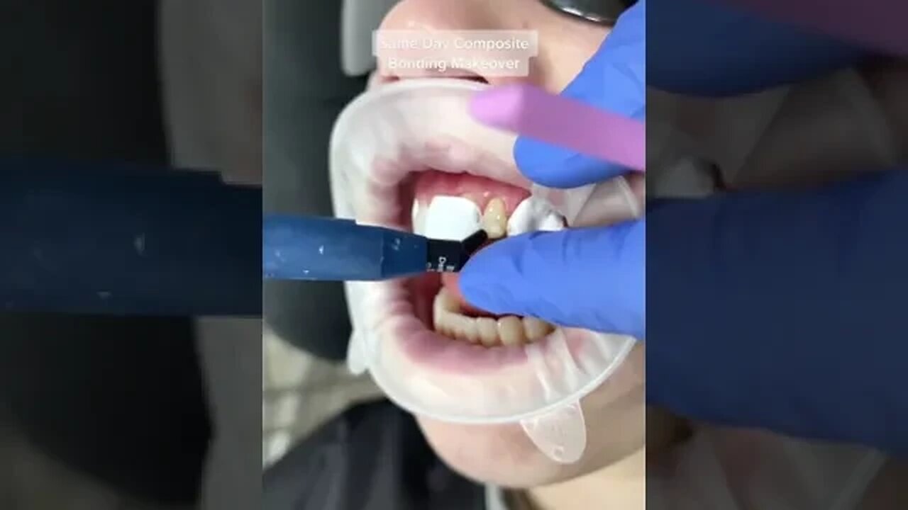 Dental And Teeth Hygiene