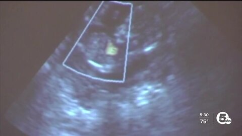 Pro-life supporters react to Roe v. Wade reversal, set goal of ending abortion in Ohio