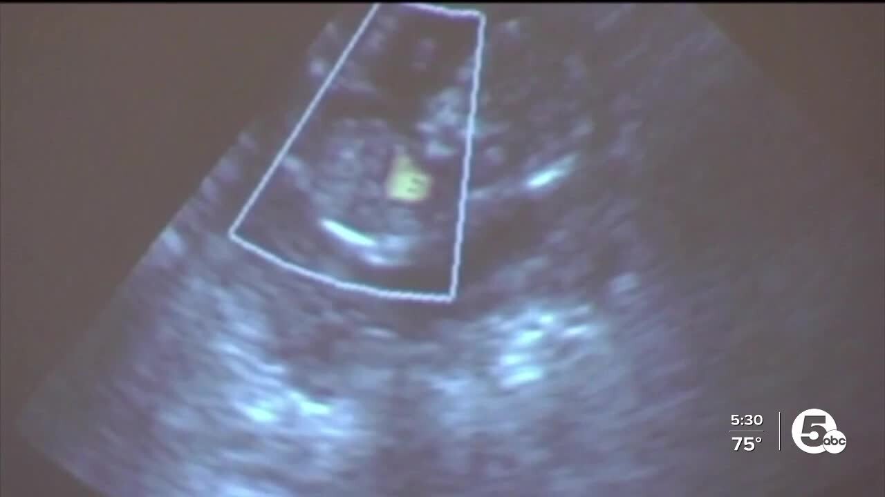 Pro-life supporters react to Roe v. Wade reversal, set goal of ending abortion in Ohio
