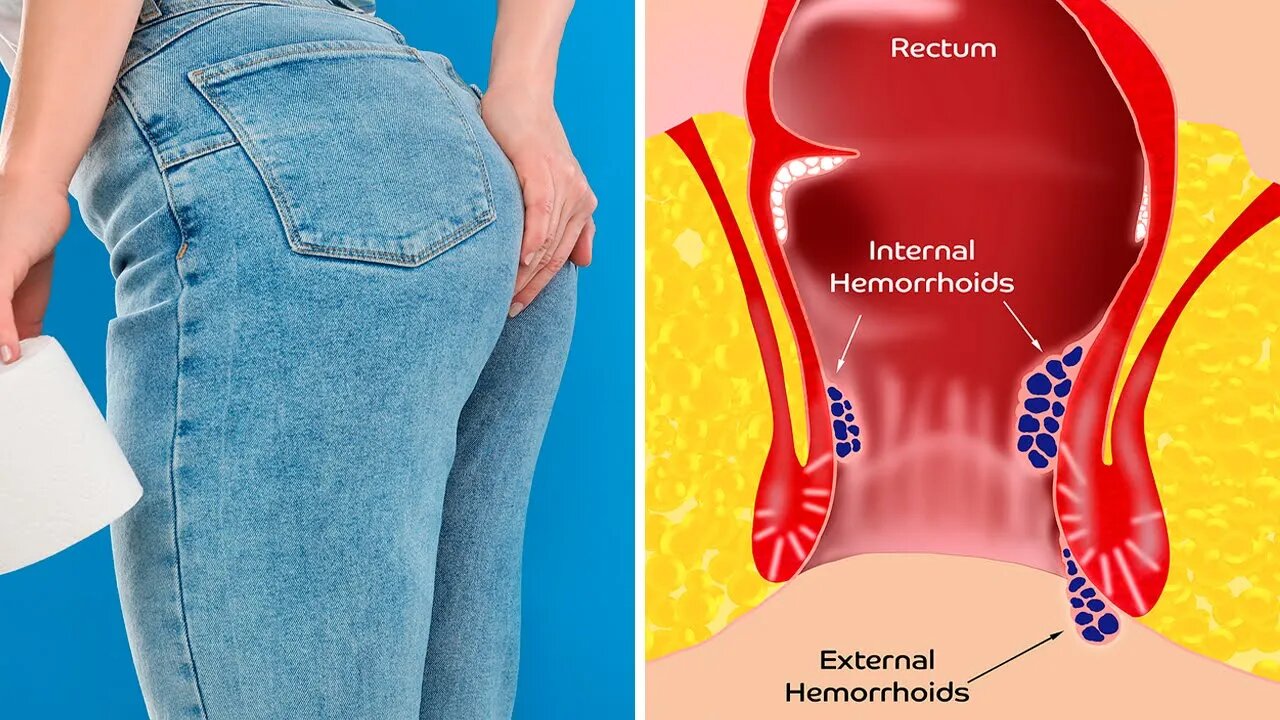 What Happens To Your Body When You Don’t Poop Every Day