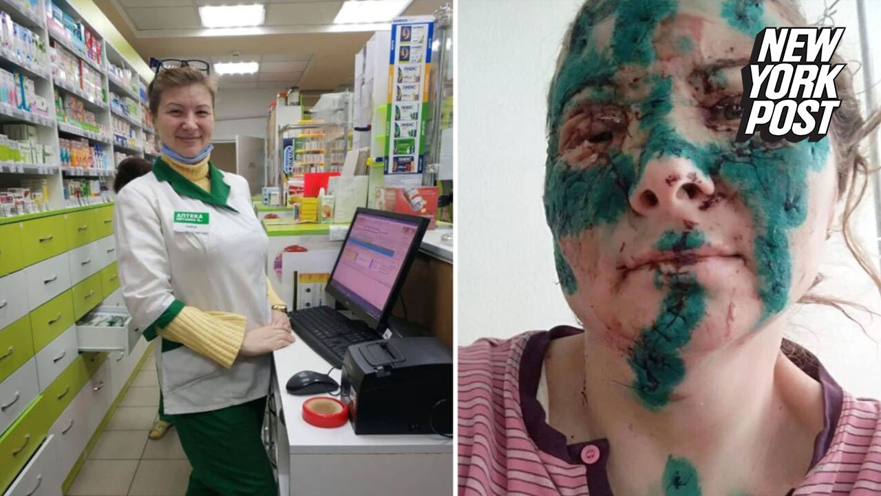 Ukrainian pharmacist reveals horror injuries after surviving hit from Russian shell