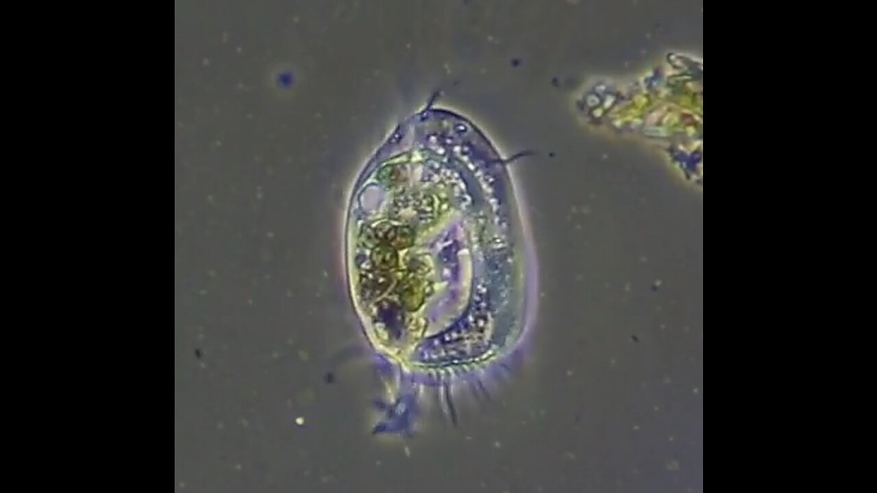 Covid-19 rapid antigen test (RAT) added to protozoa in swamp water sample