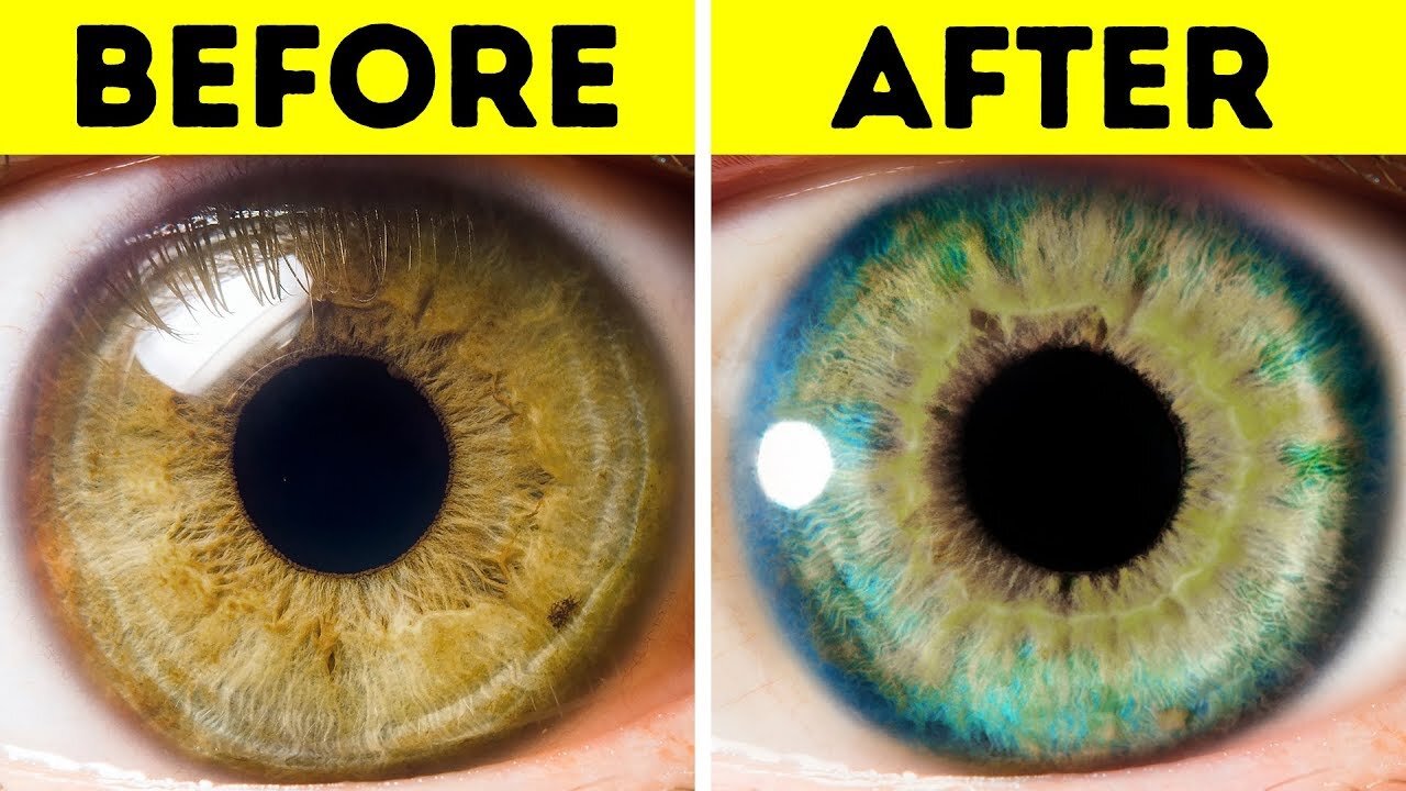 7 Things That Can Change Your Eye Color