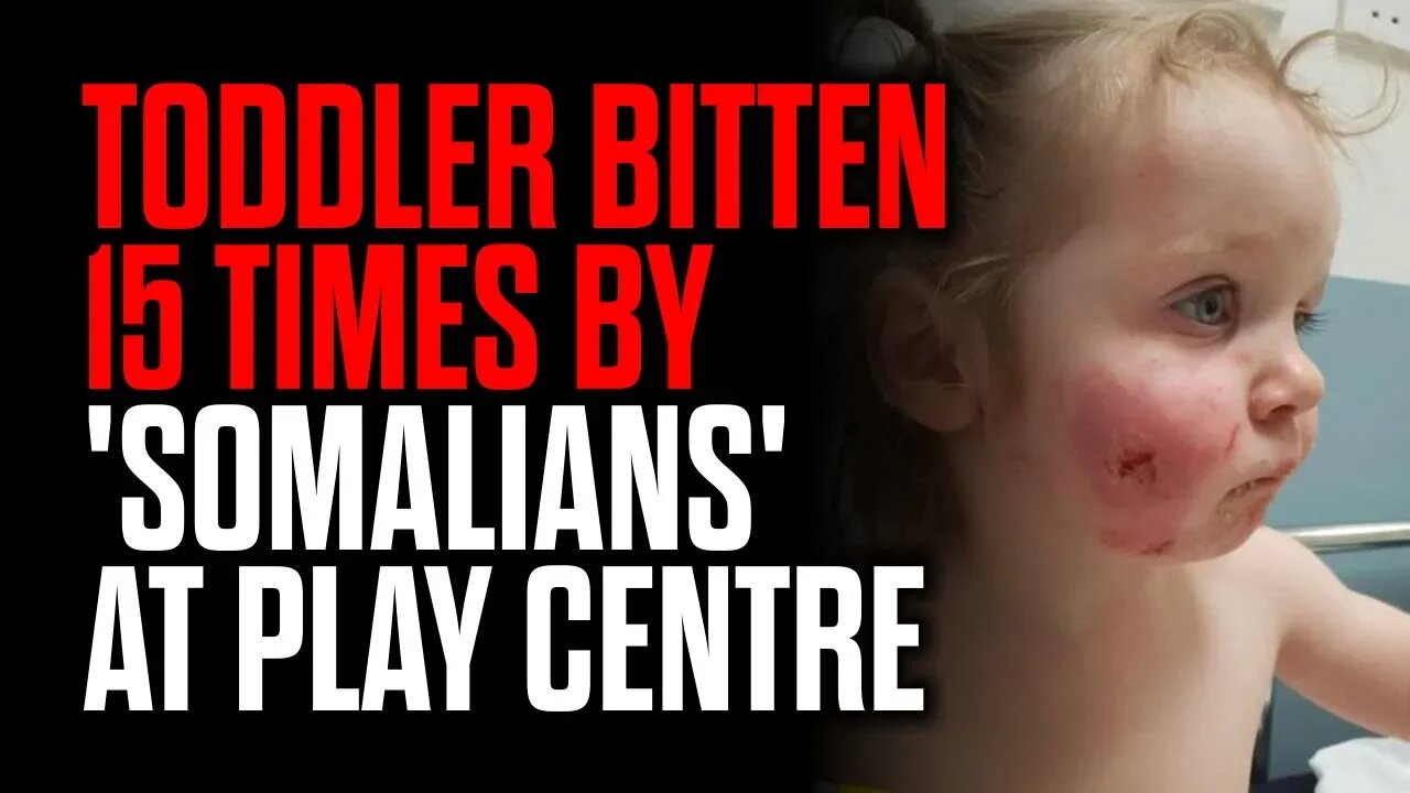 Toddler Bitten 15 Times by 'Somalians' at Play Centre