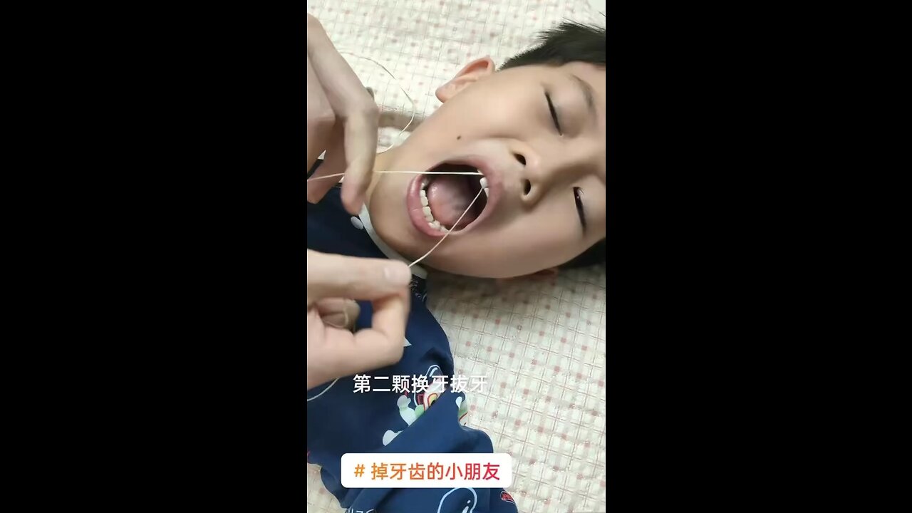 Boy pulling teeth out