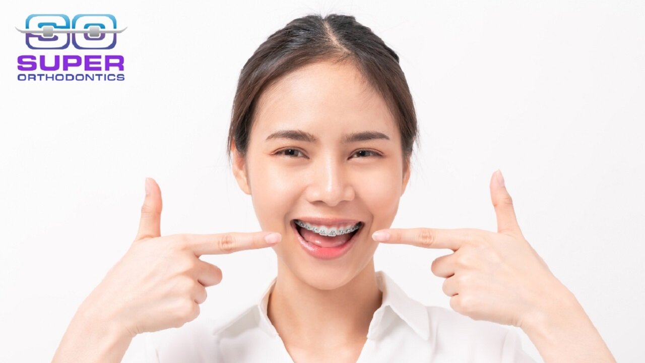 Transform Your Smile with Super Orthodontics | Braces & Invisalign in Encino, Los Angeles