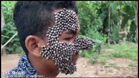 Ticks