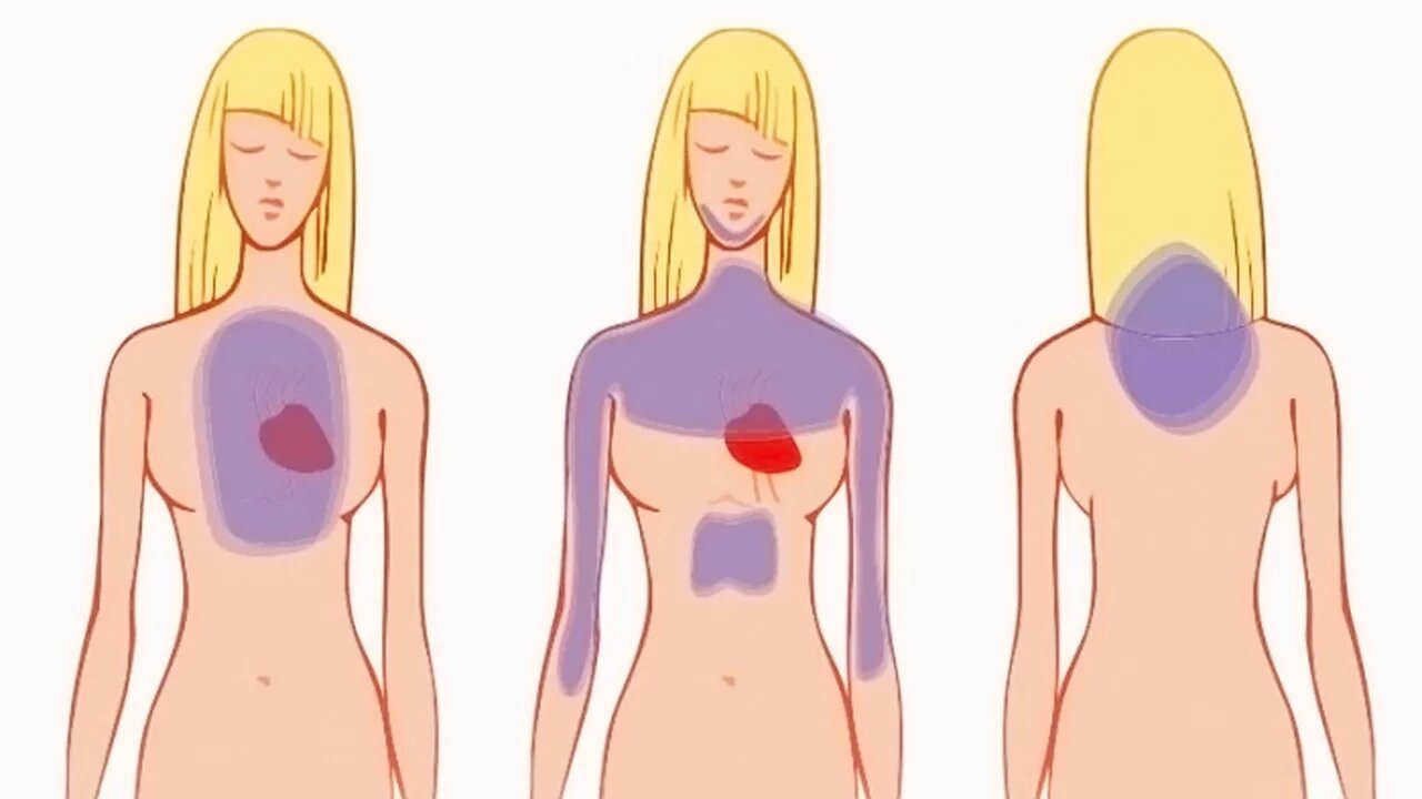 How To Recognize A Heart Attack One Month Before It Happens