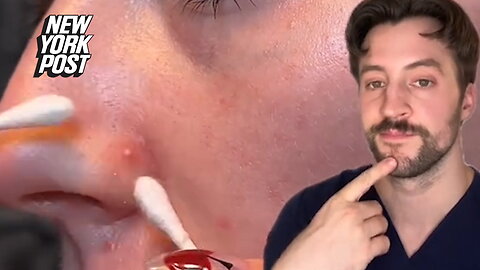 I'm a dermatologist — never pop a pimple that falls in the 'triangle of death'