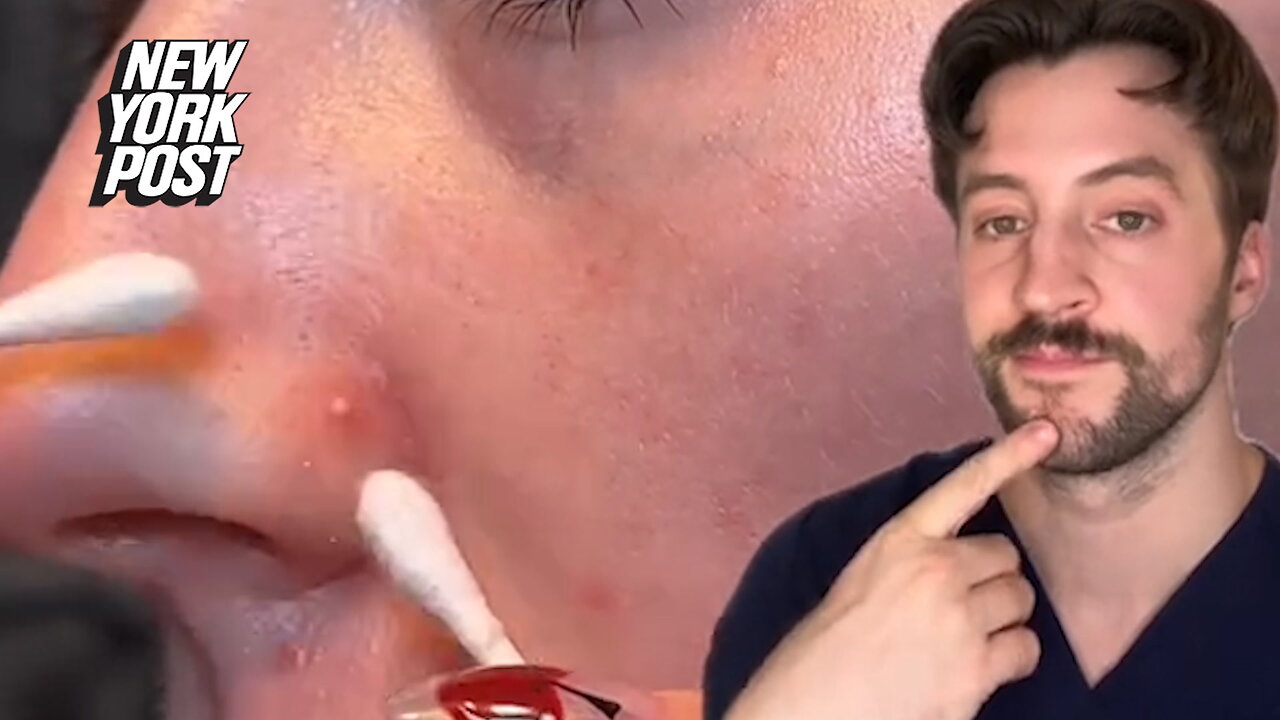I'm a dermatologist — never pop a pimple that falls in the 'triangle of death'