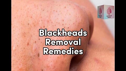 Blackheads Removal Remedies