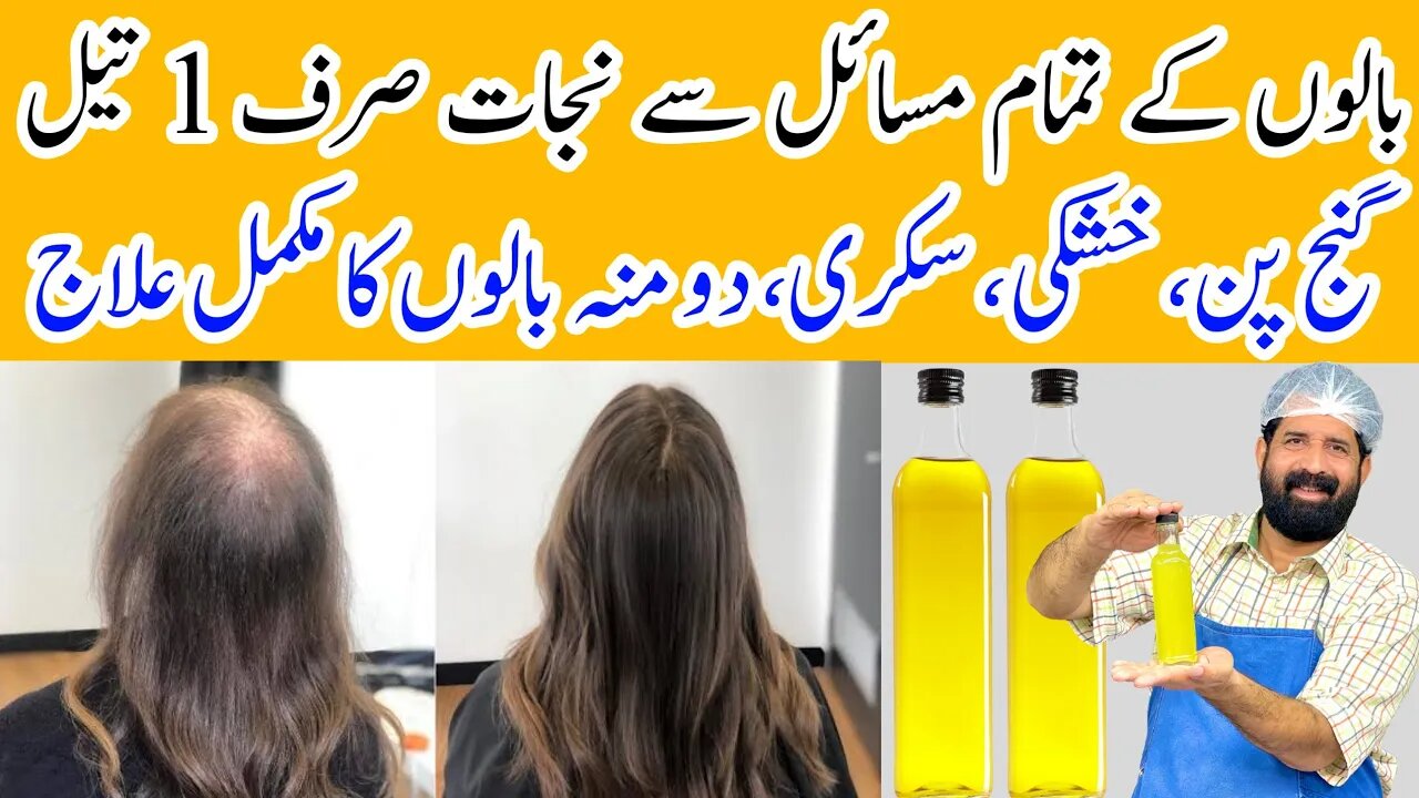 Stop 🖐 Hair Fall 100% | Faster Growth Magical Onion Oil at Home