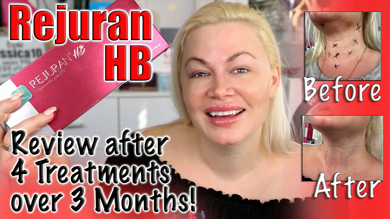 Rejuran HB - 4 Treatment Results from AceCosm | Code Jessica10 saves you Money at Approved Vendors