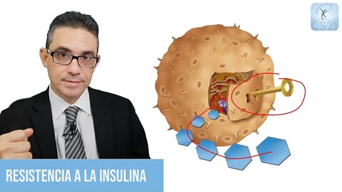 Resistencia a la Insulina