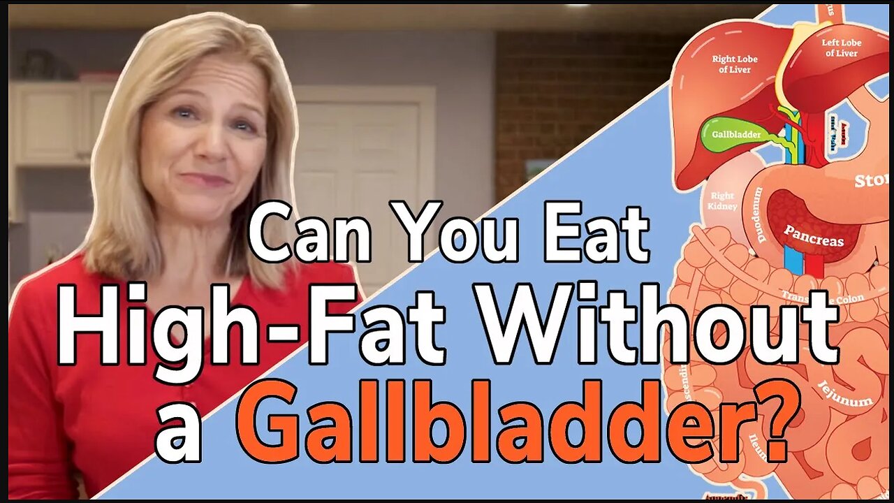 Can I Eat High Fat Without a Gallbladder?