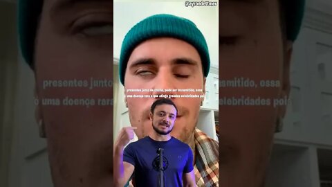 Esse é o motivo para o rosto do Justin bieber ter ficodo paralisado