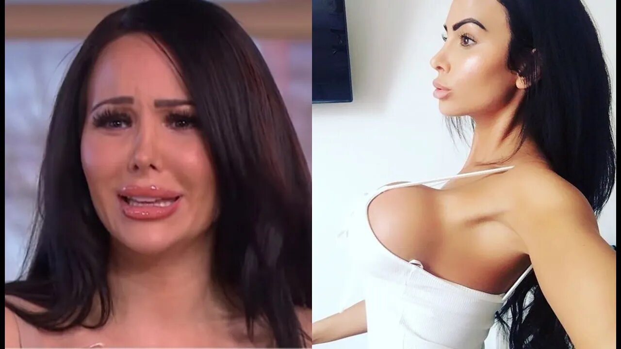 UK "IG Model" Star Delguidice ADMIT She REGRETS Getting Fake Assets After B0TCHED Surgery.