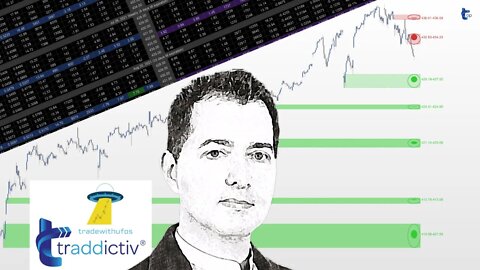 Strategy Trading REPLAY - OPTIONS | 2022 Sep-8