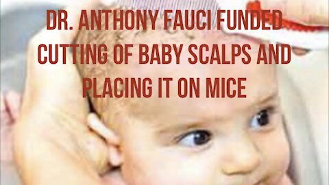 Must Watch !!!!! Taking scalps of 5months old babies and attaching it to mice