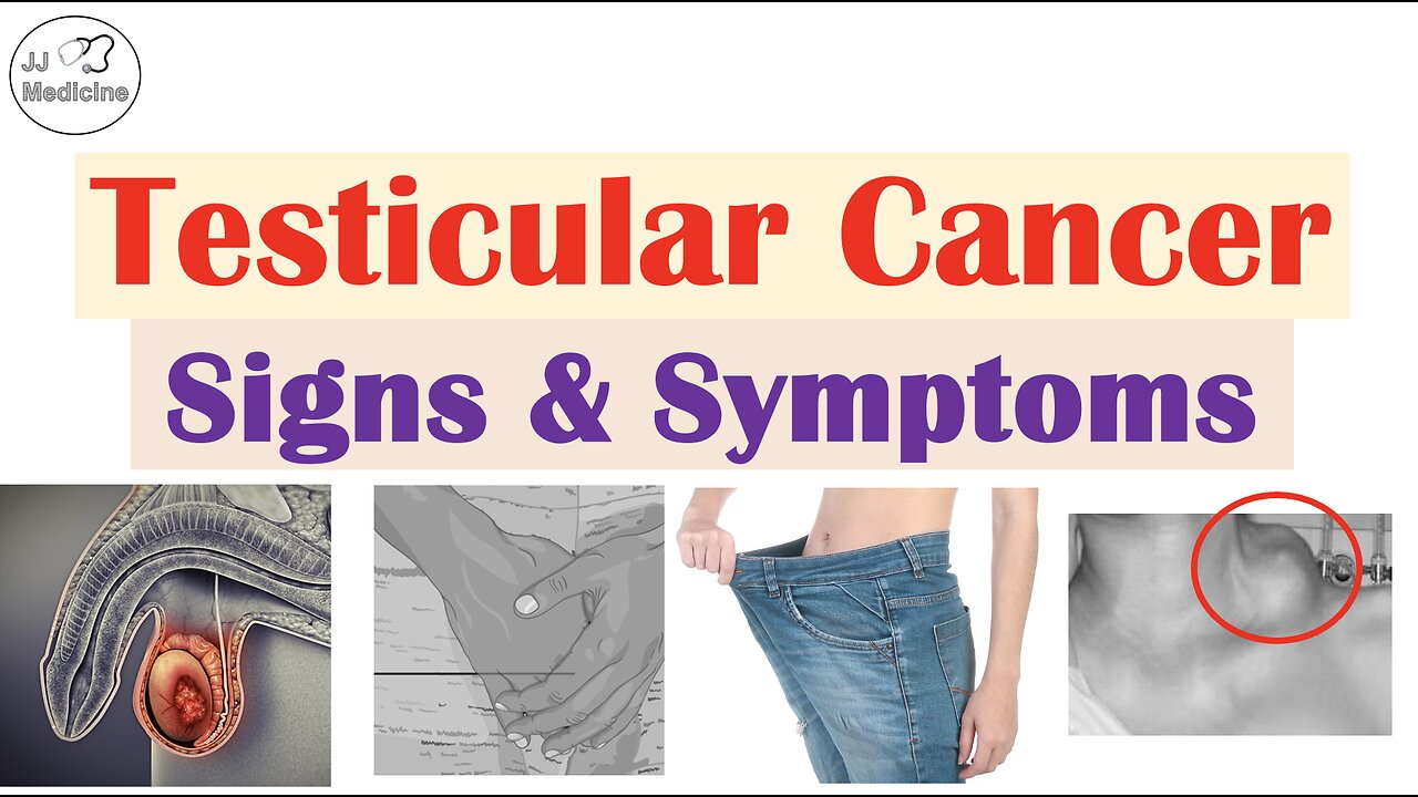 Testicular Cancer Signs and Symptoms, Risk Factors & Metastases