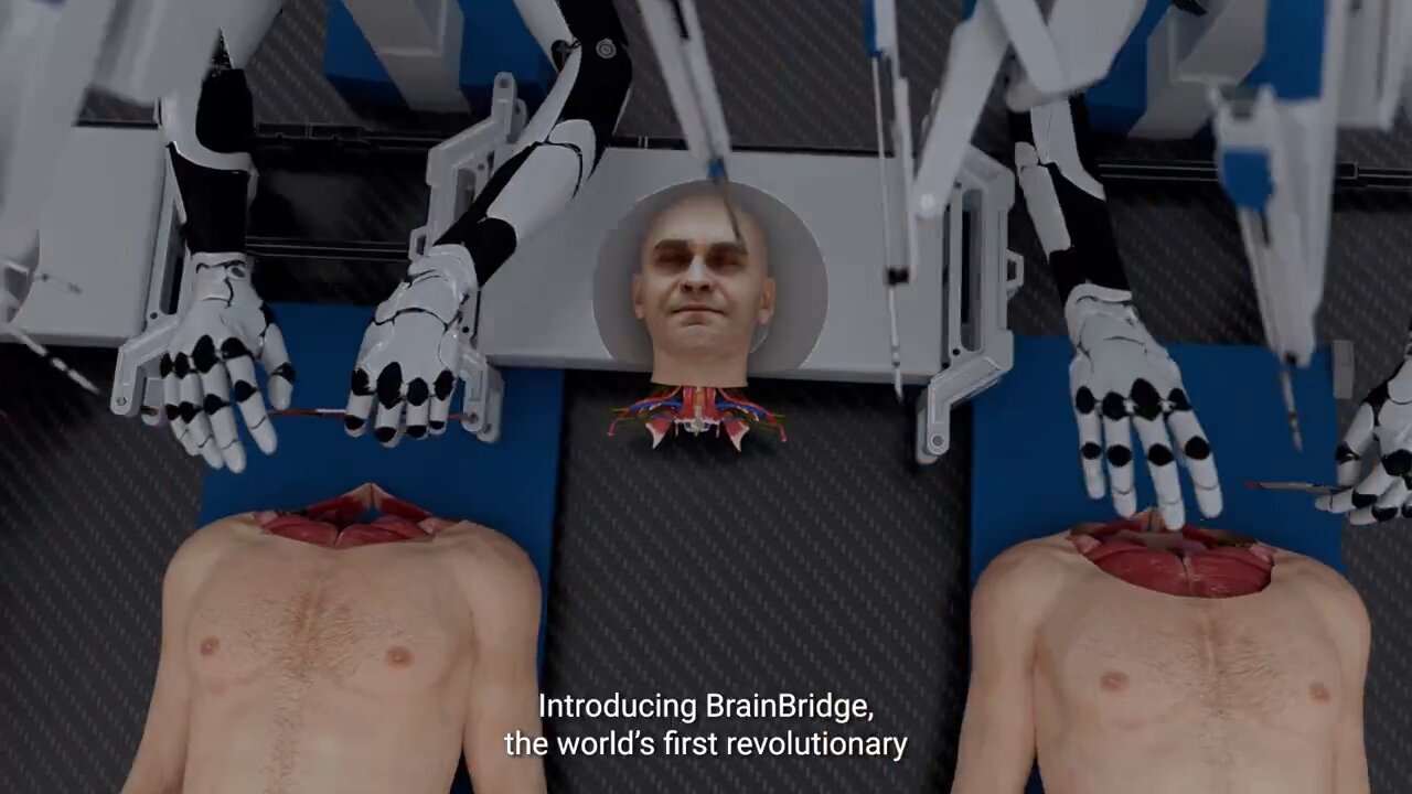 The world's first head transplant machine.