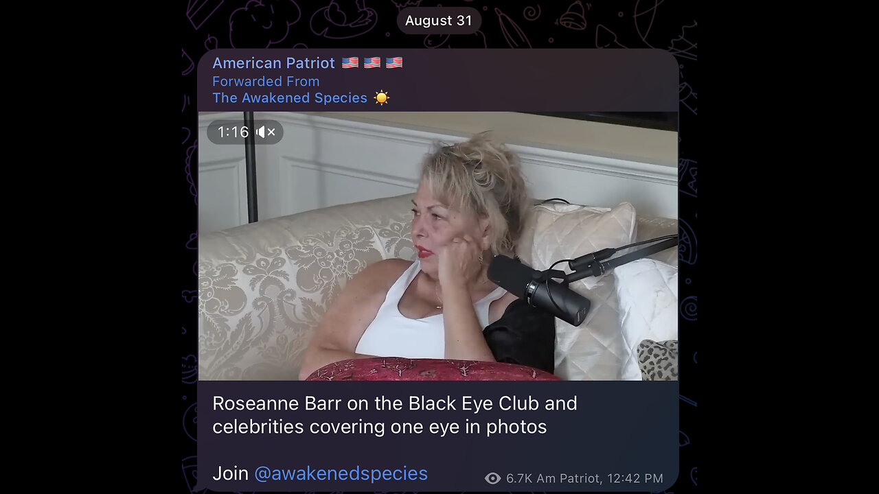 Roseanne Barr on the Black Eye Club and celebrities covering one eye in photos