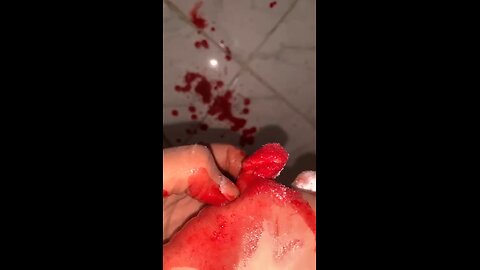 How my foot get injured