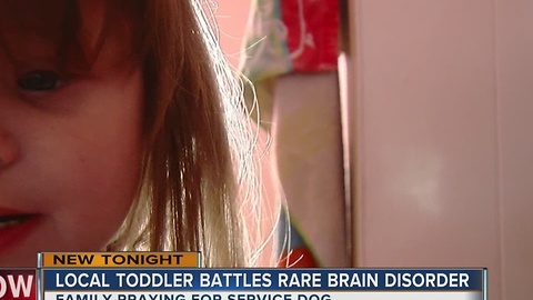 Local Toddler Battles Rare Brain Disorder