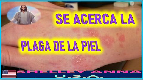 SE ACERCA LA PLAGA DE LA PIEL - MENSAJE DE JESUCRISTO A SHELLEY ANNA 20 MARZO 2022