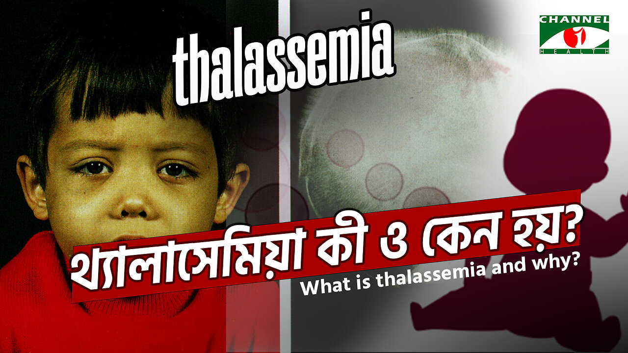 থ্যালাসেমিয়া কী ও কেন হয় জেনে নিন | Causes, Symptoms and Treatment | Thalassemia