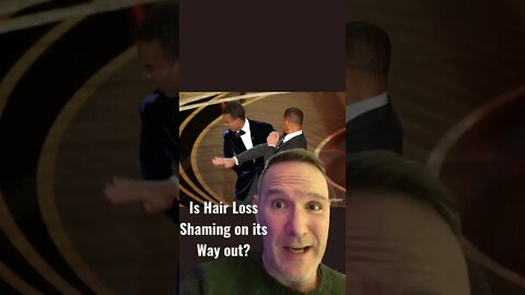 Hair Loss Shaming. Is this the end? Thanks #willsmith and #chrisrock