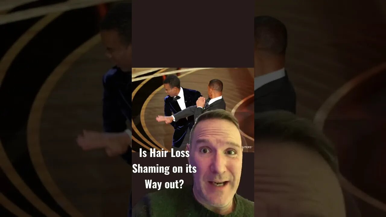 Hair Loss Shaming. Is this the end? Thanks #willsmith and #chrisrock