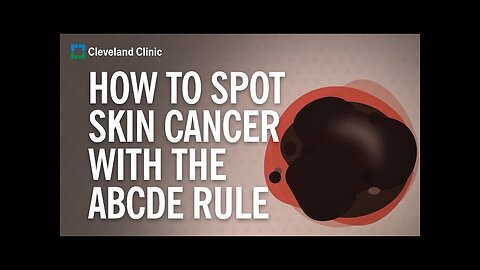 What Does Skin Cancer Look Like?