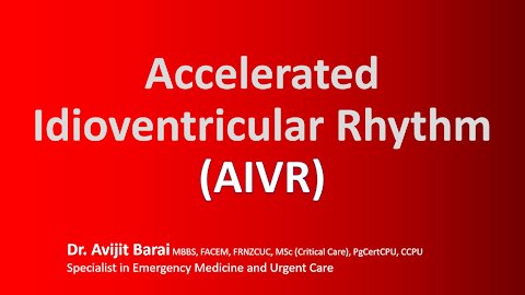 7 things you did not know about the Accelerated Idioventricular Rhythm (AIVR) ECG vs Vtach (VT)