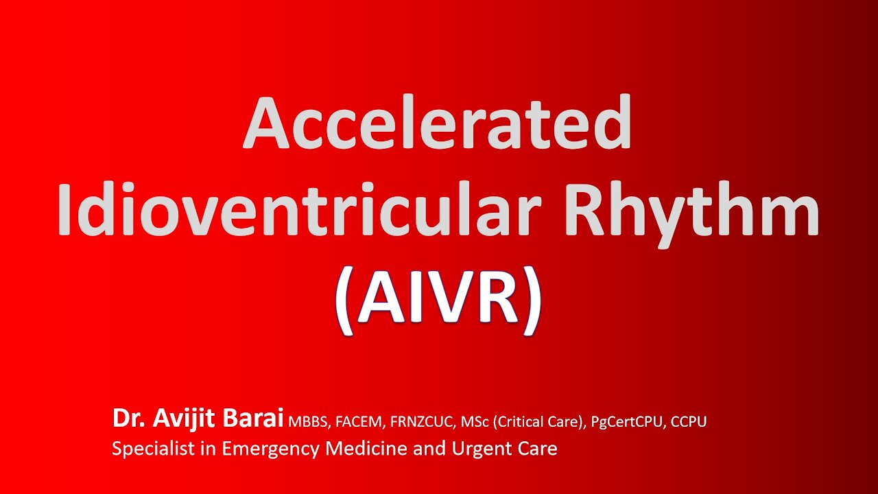 7 things you did not know about the Accelerated Idioventricular Rhythm (AIVR) ECG vs Vtach (VT)